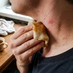 Metoda populară secretă împotriva erupțiilor pe gât funcționează fără eșec metoda-populara-secreta-impotriva-eruptiilor-pe-gat-functioneaza-fara-esec.webp.webp